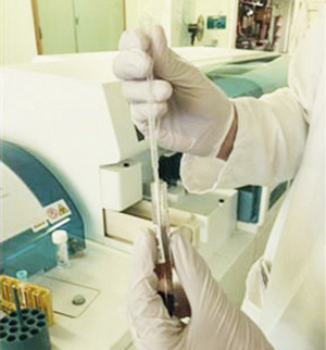 Serum used for analysis is transferred to an analyser cup, using a 1ml Pastette, before being placed on the analyser. This will prevent short sampling.